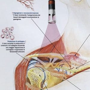 fisiowinkler bologna efficacia della tecnica terapeutica del Laser