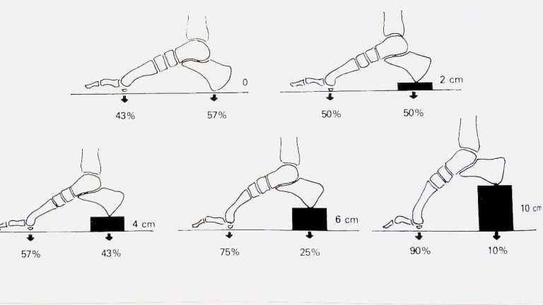 gli adattamenti posturali delle ossa del piede in base all'altezza del tacco della scarpa