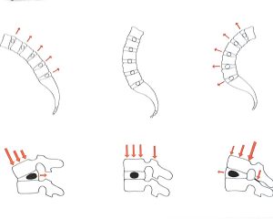 anatomia dischi vertebrali diverse posizioni della spina dorsale