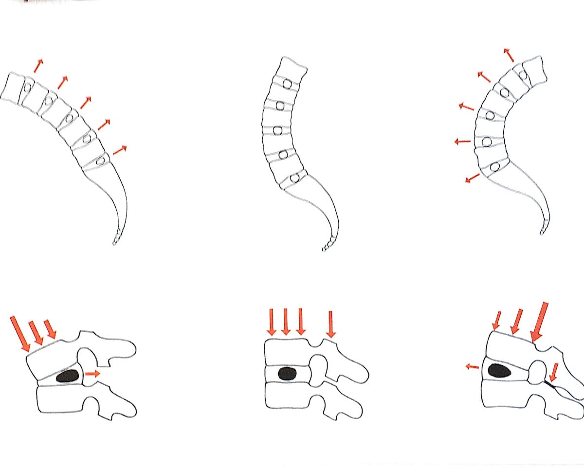 anatomia dischi vertebrali diverse posizioni della spina dorsale