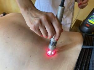 sessione terapia con il laser