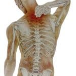 figura anatomica infiammazione orto traumato al collo contro i traumi