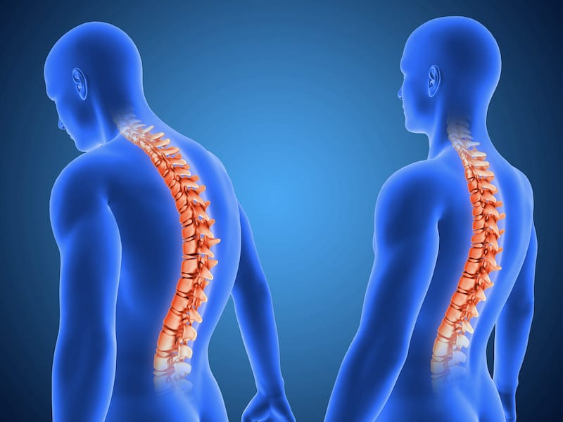 disegno anatomia umana di giovane uomo raffigurante due diverse posture della spina dorsale