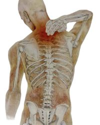 figura anatomica infiammazione orto traumato al collo contro i traumi